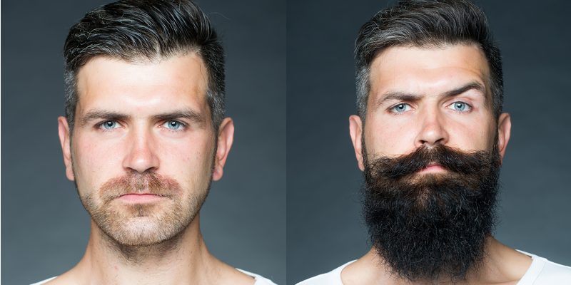 Os supostos motivos para a barba n o crescer O Blog da Men s