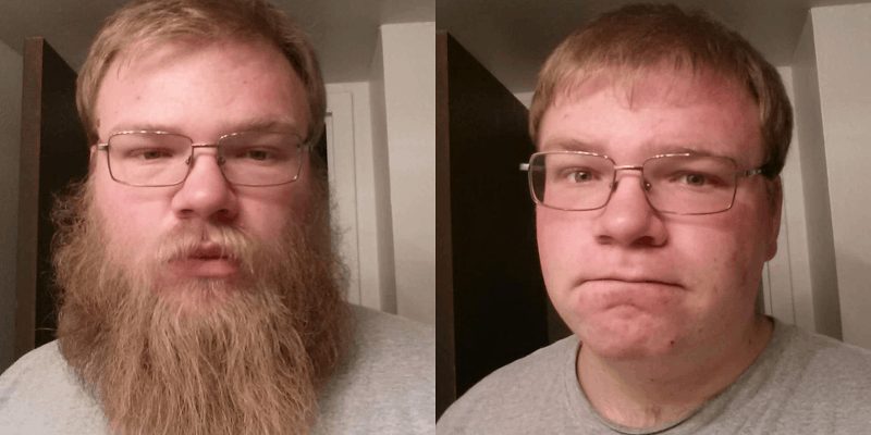 homens com e sem barba diferença
