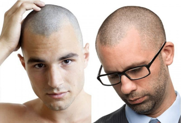 corte de cabelo masculino zero do lado